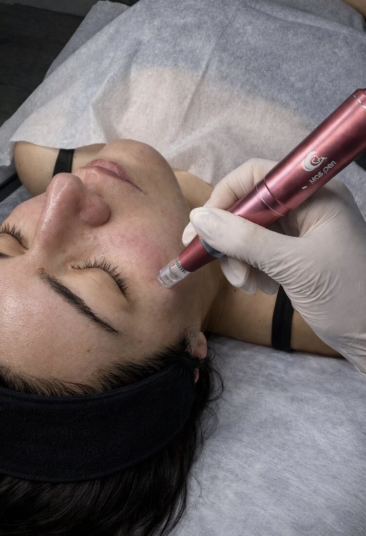 Tratamiento facial profesional
